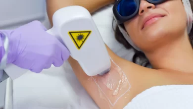 The 5 Most Significant Benefits of Laser Hair Removal
